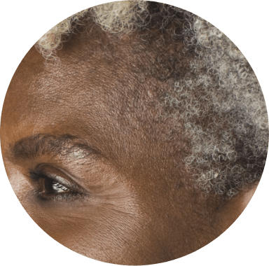 Hair texture can pose challenges for patients of color